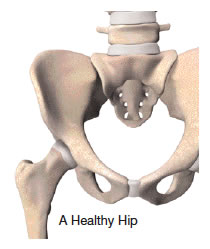Total Hip Joint Replacement in El Paso TX